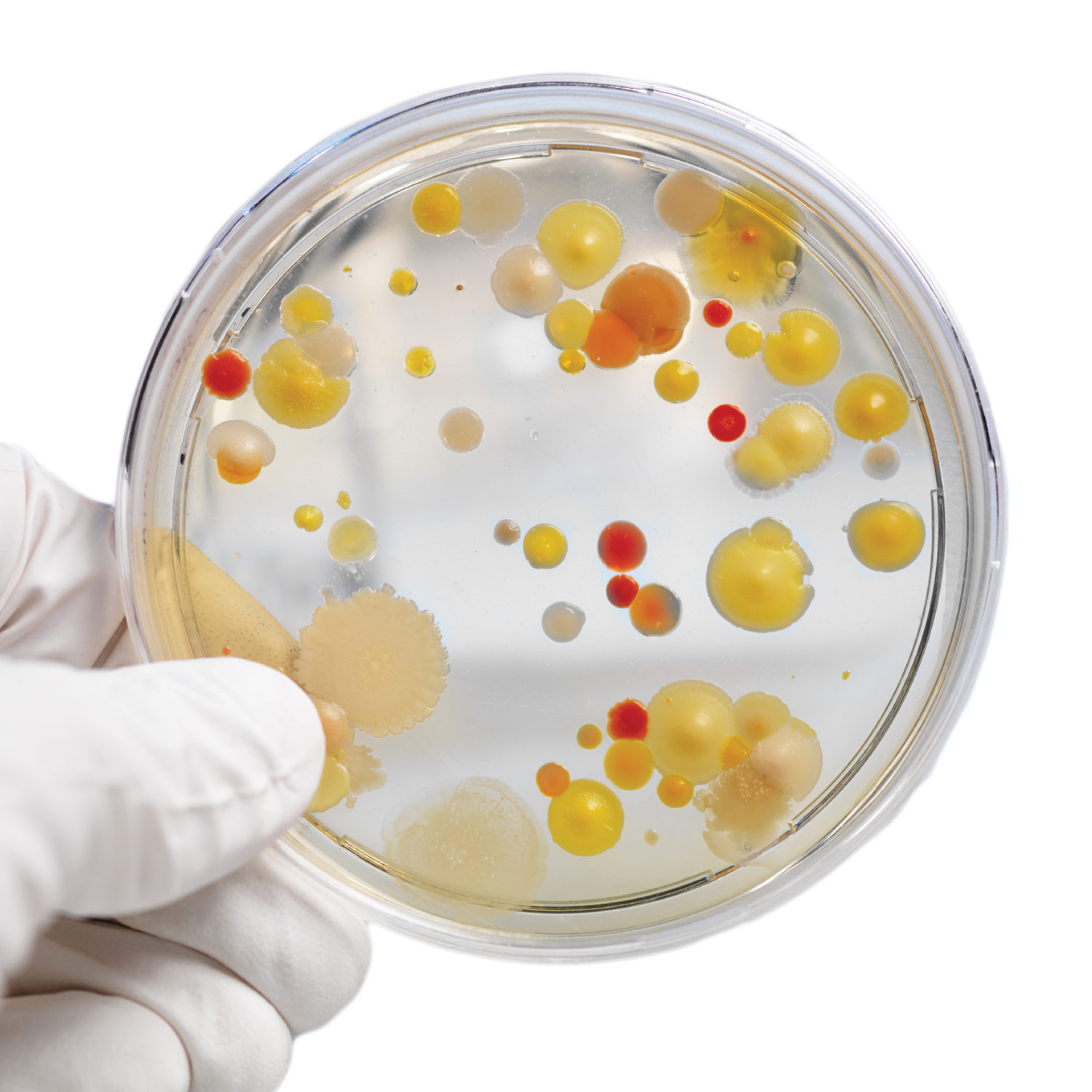 petri dish bacteria growth